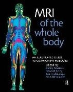 Nikhil Bhuskute, Nikhil Hoey Bhuskute, Bhuskute Nikhil, Edward Hoey, Edward (Consultant Radiologist Hoey, … - Mri of the Whole Body An Illustrated Guide for Common Pathologies