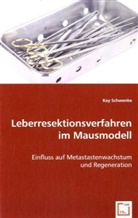 Kay Schwenke - Leberresektionsverfahren im Mausmodell