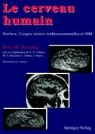 Henri M. Duvernoy, DUVERNOY HENRI M., J. -L. Vannson, J. -L Vannson, J. -L. Vannson, J.-L. Vannson - LE CERVEAU HUMAIN SURFACE  COUPES SERIEE