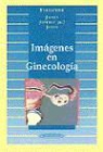 Jeffrey R. Brooke, Arthur C. Fleischer, Arthur C. . . . [et al. ] Fleischer, Marcia C. Javitt - Imágenes en ginecología