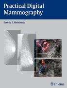 Hashimoto, Beverly Hashimoto, Beverly E. Hashimoto - Practical Digital Mammography