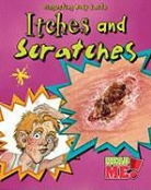 Angela Royston - Itches and Scratches