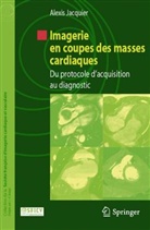 9782287996955, Alexis Jacquier, Alexis Jacquier, Jacquier Alexis - Imagerie en coupes des masses cardiaques : du protocole d'acquisition au diagnostic