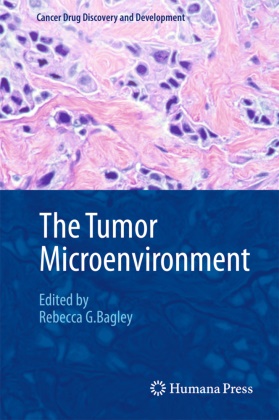 Rebecca G. Bagley, Rebecc G Bagley, Rebecca G Bagley - The Tumor Microenvironment