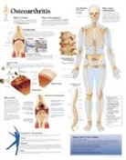 Scientific Publishing, Various - Osteoarthritis Paper Poster