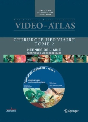 Cavit Avci, Avci/fourtanier, Levent Avtan, Cavit Avci, Collectif, … - Chirurgie herniaire. Vol. 2. Hernie de l'aine, techniques vidéoscopiques Chirurgie herniaire