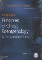 Larence R. Goodman, Lawrence R. Goodman - Felson's Principles of Chest Roentgenology