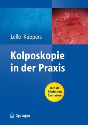 Küppers, Volkmar Küppers, Lell, Ralph J. Lelle, Ralph Lellé, … - Kolposkopie in der Praxis Mit 50 klinischen Szenarien