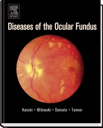 Bertil Damato, Kanski, Jack J. Kanski, Stanislaw A. Milewski - Disease of the Ocular Fundus