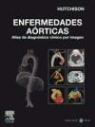 Stuart J. Hutchison - Enfermedades aórticas : atlas de diagnóstico por imagen