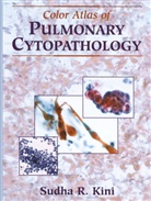 Sudha R Kini, Sudha R. Kini, Sudha R. Pathology Images Inc, Pathology Images Inc., Pathology Images Inc. - Color Atlas of Pulmonary Cytopathology