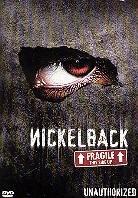 Nickelback - Unauthorized: Fragile - This side up