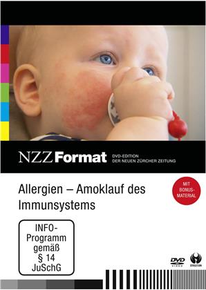 Allergien: Amoklauf des Immunsystems - NZZ Format