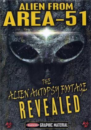 Alien from Area 51 - The Alien Autopsy Footage Revealed