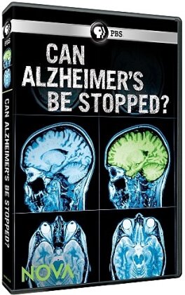 NOVA - Can Alzheimer's Be Stopped
