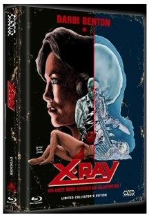 X-Ray - Der erste Mord geschah am Valentinstag (1981) (Cover B, Collector's Edition, Limited Edition, Mediabook, Uncut, Blu-ray + DVD)