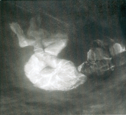 Alice Phoebe Lou - Glow