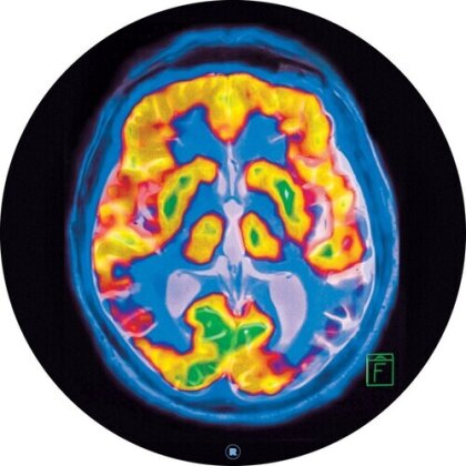 Frankey & Sandrino - Brainscan (12" Maxi)