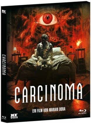 Carcinoma (2014) (Étui)